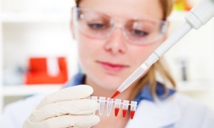 Анализ лейкоцитов в крови: исследование от «А» до «Я»