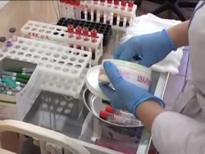 Как сдавать кровь на ВИЧ для получения точного результата